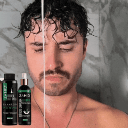 ADIÓS CALVICIE Solución para Crecimiento y Anticaída con (Minoxidil 7%)